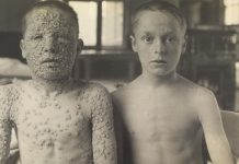 Scurt istoric al antivaxxerilor